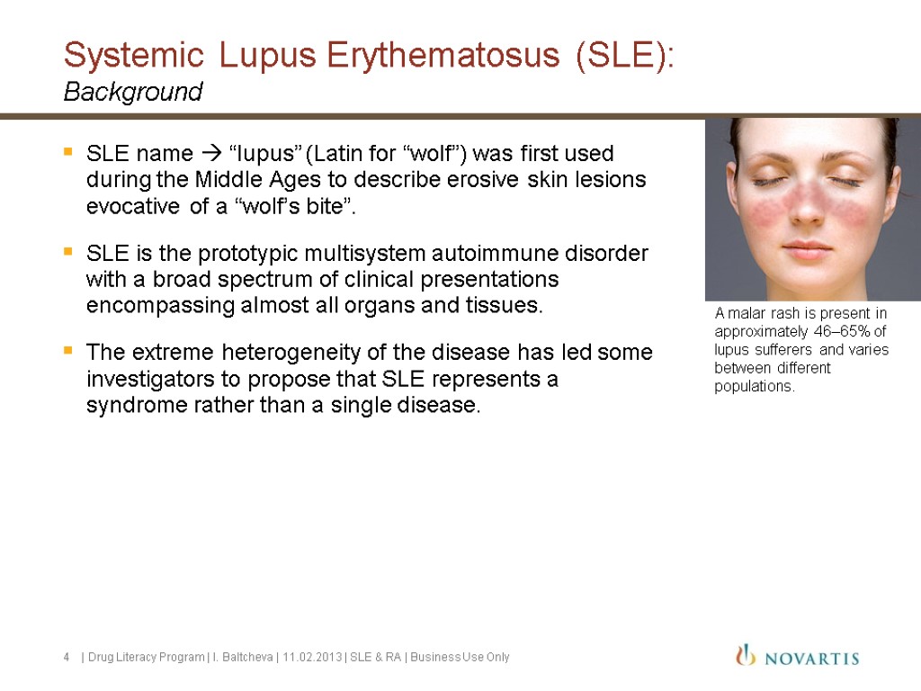 4 1 World Alzheimer Report 2010 SLE name  “lupus” (Latin for “wolf”) was